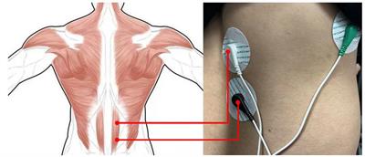 Improving wheelchair user sitting posture to alleviate lumbar fatigue: a study utilizing sEMG and pressure sensors